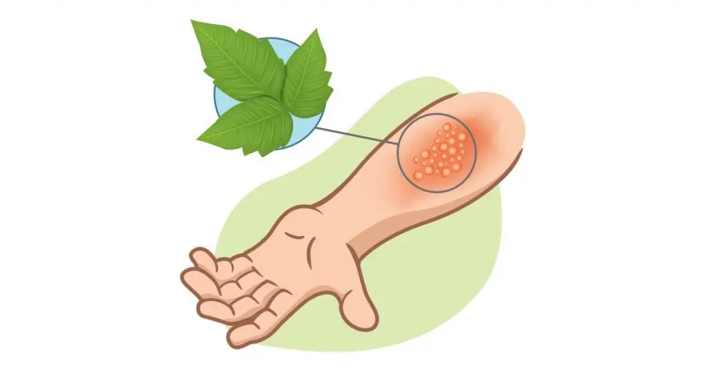 Poison Ivy Identification: Treat & Prevent